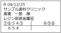 24mmテープ レイアウトB：納品日 / 得意先名 / 患者名 / 補綴物 / 歯式（納品のみ）